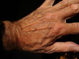 Hand